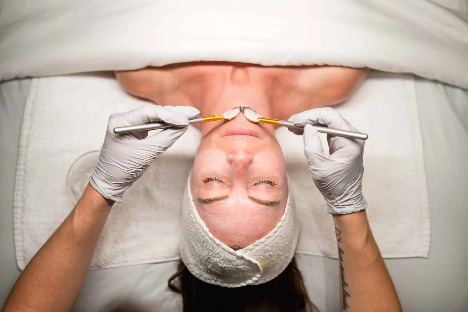 Chemical peel treatment at Banyan and Bamboo Austin TX med spa